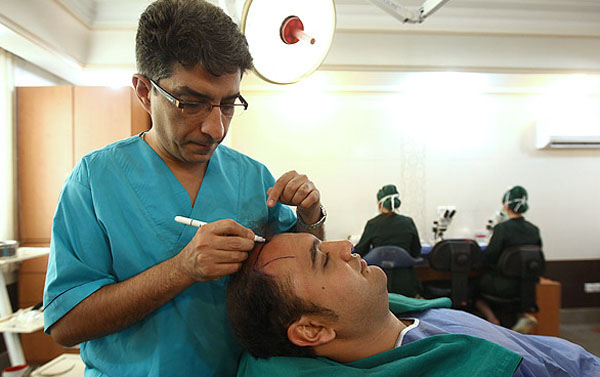 زرع الشعر في ايران