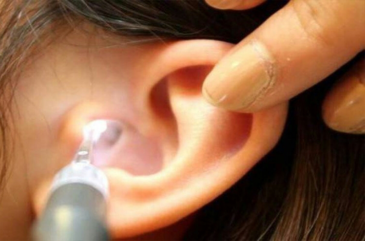 «علامة» في شحمة الأذن تنذرُ بجلطة دماغية..فكونوا حذرين!