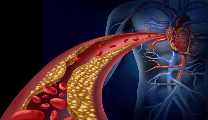  وصفة المانية لفتح الشرايين المسدودة وتخفض الكوليسترول