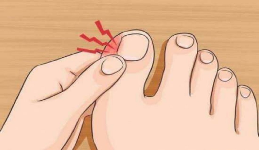 أفضل الطرق الطبيعية لمعالجة وتجنّب انغراز أظافر القدم باللحم 