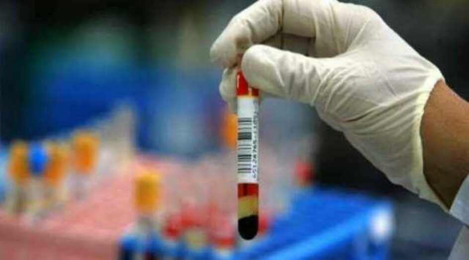 العلم ينسف "الخطأ التاريخي" بشأن فيتامين دي