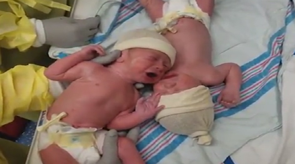 سابقة تاريخية .. أم تلد طفلين خلال أسبوعين +الصورة