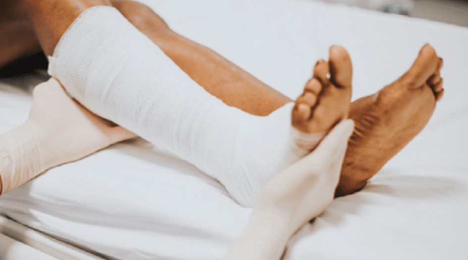 تقنية جديدة للتخلص من تجلطات الساق