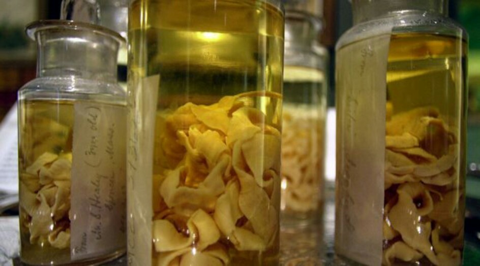 كيف تعرف أن “الدودة الشريطية” تعيش داخلك