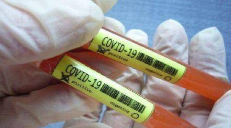 علماء يكتشفون عقارا “يدمر فيروس كورونا في 48 ساعة”