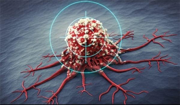 تدشين أول مركز شامل لعلاج السرطان في ايران